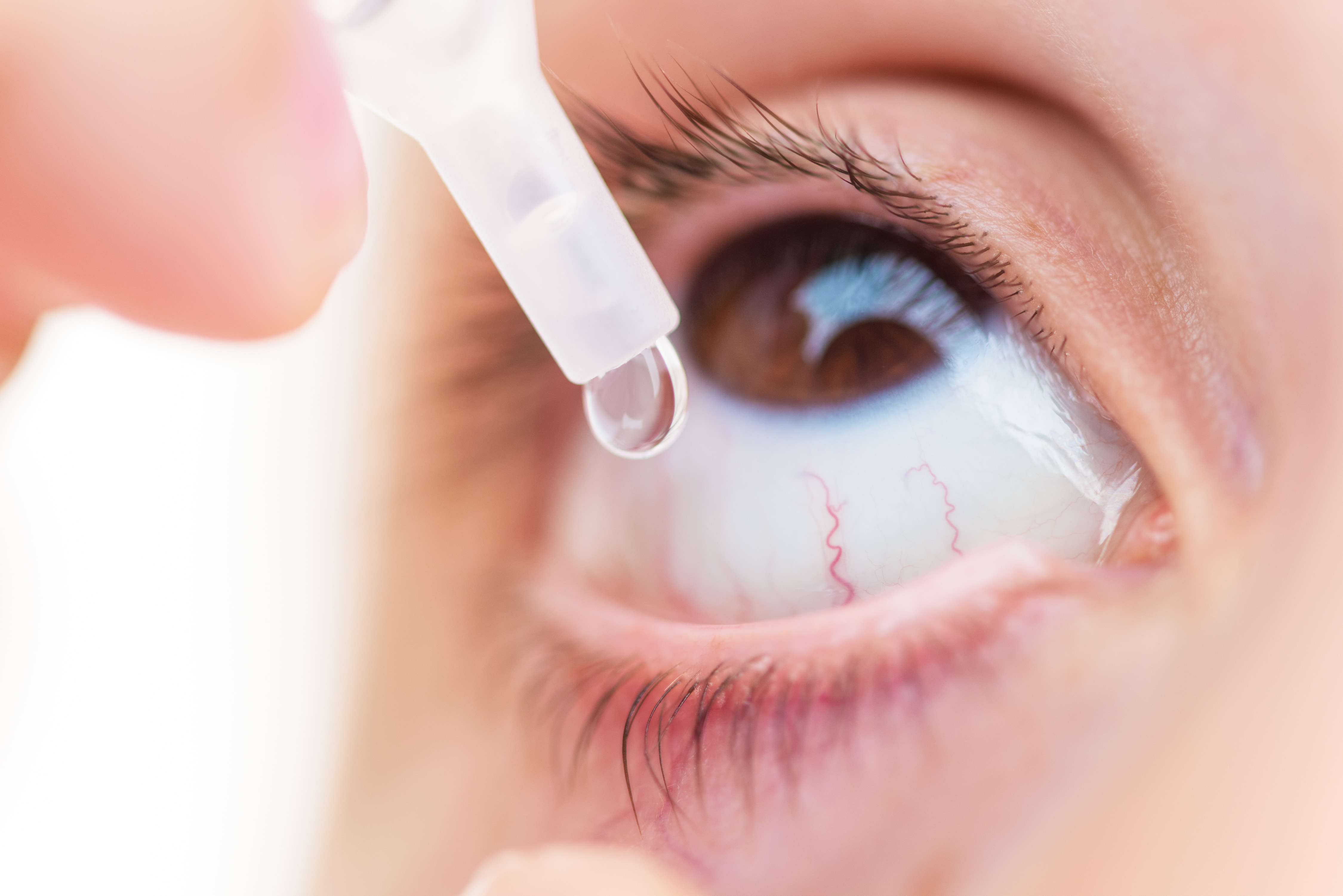 Eye drop being instilled into eye.